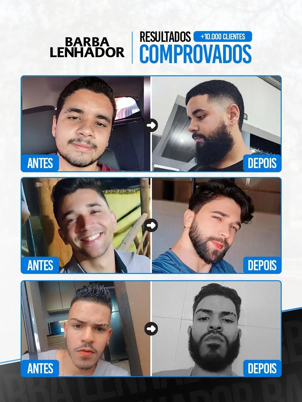 Minoxidil Kirkland 5% + Ativador de crescimento MAJOR - BARBA LENHADOR